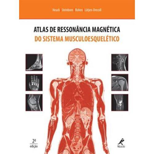 Tamanhos, Medidas e Dimensões do produto Atlas de Ressonância Magnética do Sistema Musculoesquelético