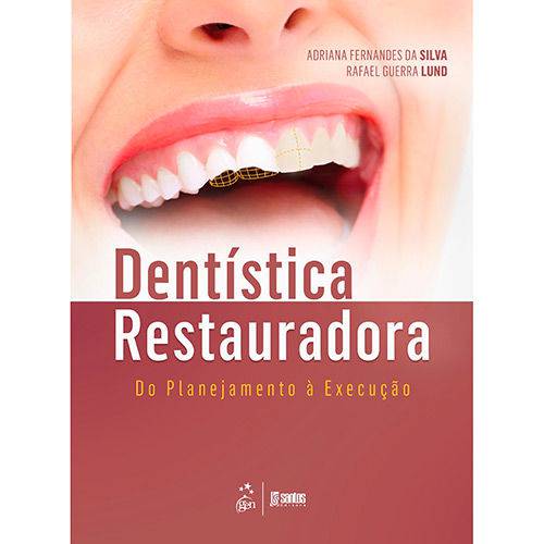 Tamanhos, Medidas e Dimensões do produto Dentística Restauradora - do Planejamento à Execução - 1ª Ed.