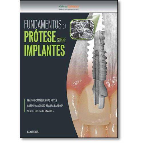 Tamanhos, Medidas e Dimensões do produto Fundamentos da Prótese Sobre Implantes