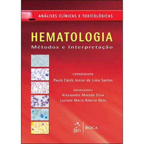 Tamanhos, Medidas e Dimensões do produto Hematologia Clinica - Metodos e Interpretaçao