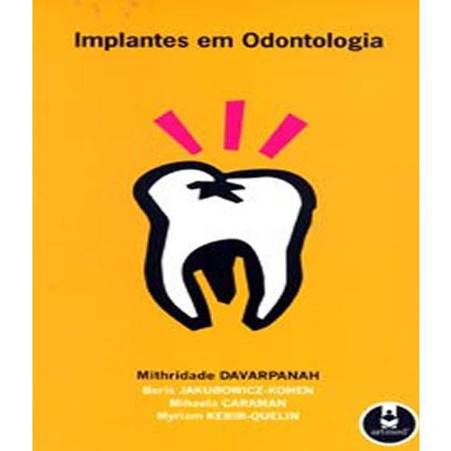 Tamanhos, Medidas e Dimensões do produto Implantes em Odontologia