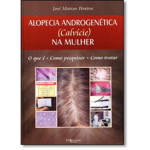 Tamanhos, Medidas e Dimensões do produto Livro - Alopecia Androgenetica ( Calvice ) na Mulher