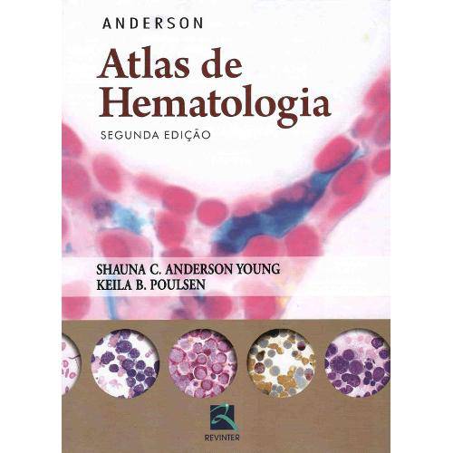 Tamanhos, Medidas e Dimensões do produto Livro - Anderson Atlas de Hematologia