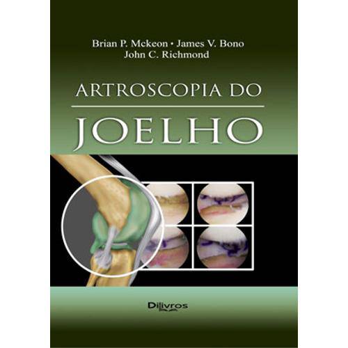 Tamanhos, Medidas e Dimensões do produto Livro - Artroscopia do Joelho - Mckeon