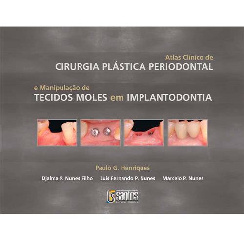 Tamanhos, Medidas e Dimensões do produto Livro - Atlas Clínico de Cirurgia Plástica e Manipulação de Tecidos Moles em Implantodontia
