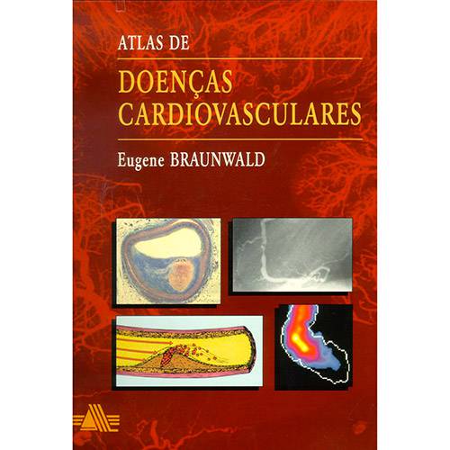 Tamanhos, Medidas e Dimensões do produto Livro - Atlas de Doenças Cardiovasculares