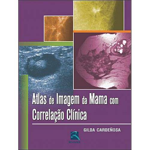 Tamanhos, Medidas e Dimensões do produto Livro - Atlas de Imagem da Mama com Correlação Clínica - Cardeñosa