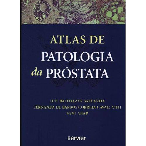 Tamanhos, Medidas e Dimensões do produto Livro - Atlas de Patologia da Prostata - Saldanha
