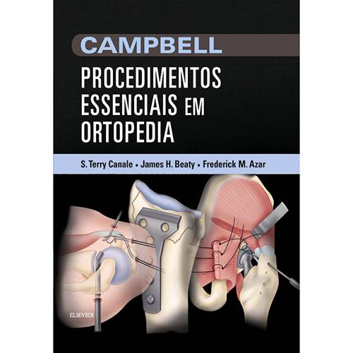 Tamanhos, Medidas e Dimensões do produto Livro - Campbell Procedimentos Essenciais em Ortopedia