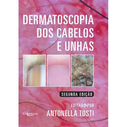 Tamanhos, Medidas e Dimensões do produto Livro - Dermatoscopia dos Cabelos e Unhas - Tosti