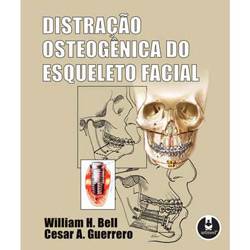 Tamanhos, Medidas e Dimensões do produto Livro - Distração Osteogênica do Esqueleto Facial