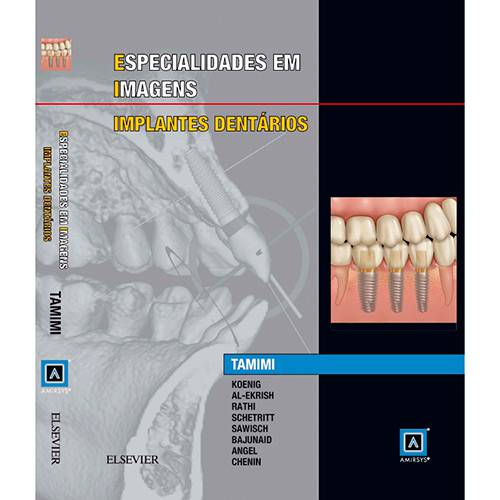 Tamanhos, Medidas e Dimensões do produto Livro - Especialidades em Imagens: Implantes Dentarios