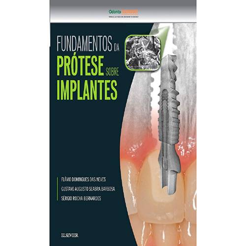 Tamanhos, Medidas e Dimensões do produto Livro - Fundamentos da Prótese Sobre Implantes