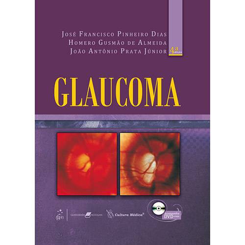 Tamanhos, Medidas e Dimensões do produto Livro - Glaucoma