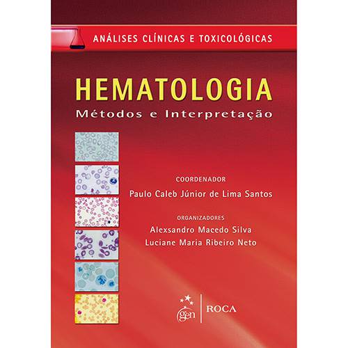 Tamanhos, Medidas e Dimensões do produto Livro - Hematologia: Métodos e Interpretação - Série Análises Clínicas e Toxicológicas