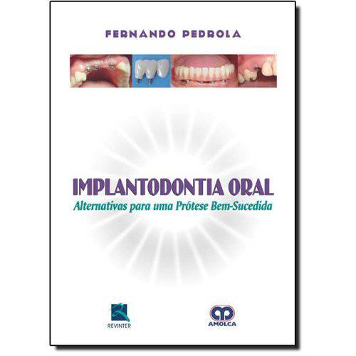 Tamanhos, Medidas e Dimensões do produto Livro - Implantodontia Oral - Alternativa para uma Prótese - Pedrola