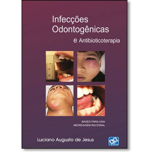 Tamanhos, Medidas e Dimensões do produto Livro - Infecções Odontogênicas e Antibioticoterapia - Jesus