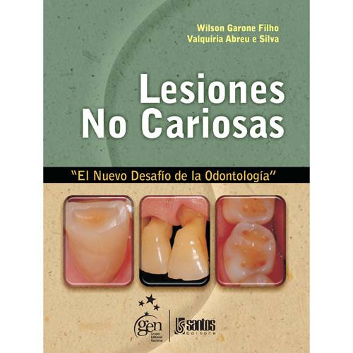Tamanhos, Medidas e Dimensões do produto Livro - Lesiones no Cariosas: El Nuevo Desafío de La OdontologÍa