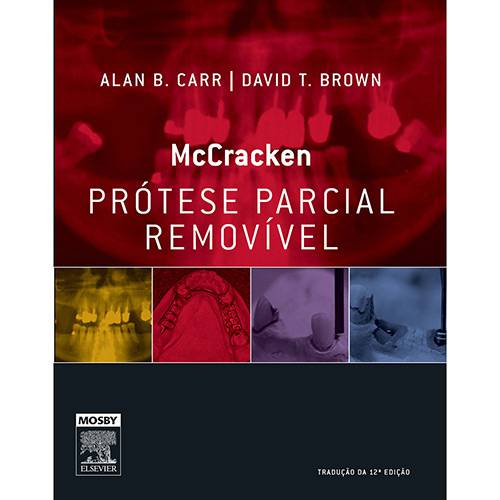 Tamanhos, Medidas e Dimensões do produto Mccracken Prótese Parcial Removível