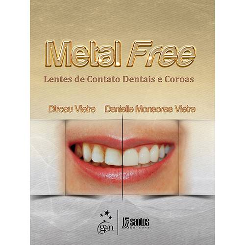 Tamanhos, Medidas e Dimensões do produto Livro - Metal Free: Lentes de Contato Dentais e Coroas