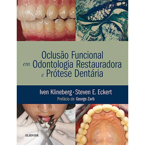 Tamanhos, Medidas e Dimensões do produto Livro - Oclusão Funcional em Odontologia Restauradora e Prótese