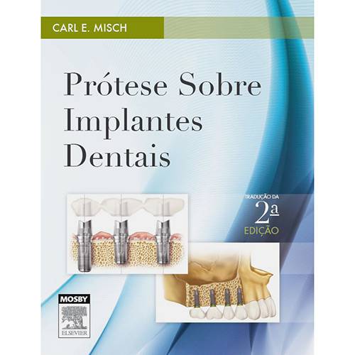Tamanhos, Medidas e Dimensões do produto Livro - Prótese Sobre Implantes Dentais
