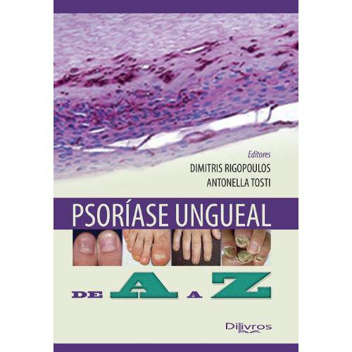 Tamanhos, Medidas e Dimensões do produto Livro - Psoriase Ungueal de a A Z - Rigopoulos