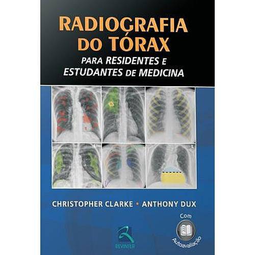 Tamanhos, Medidas e Dimensões do produto Livro - Radiografia do Tórax para Residentes e Estudantes de Medicina - Clarke