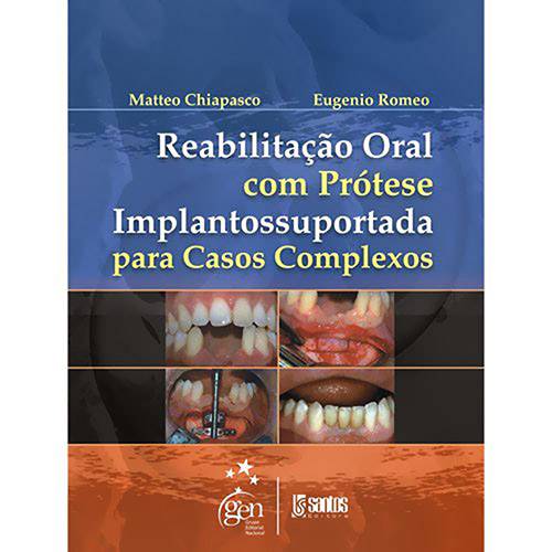 Tamanhos, Medidas e Dimensões do produto Reabilitação Oral com Protése Implantossuportada para Casos Complexos