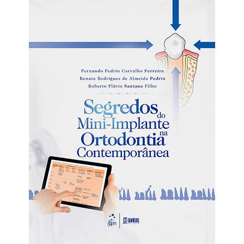 Tamanhos, Medidas e Dimensões do produto Livro - Segredos do Mini-Implante na Ortodontia Contemporânea