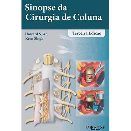 Tamanhos, Medidas e Dimensões do produto Livro - Sinopse da Cirurgia de Coluna - Singh