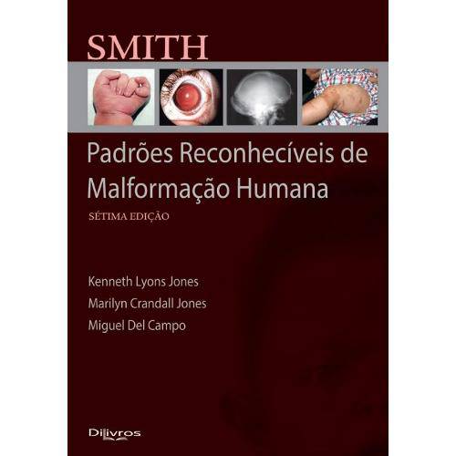 Tamanhos, Medidas e Dimensões do produto Livro - Smith Padrões Reconheciveis de Malformação Humana - Jones