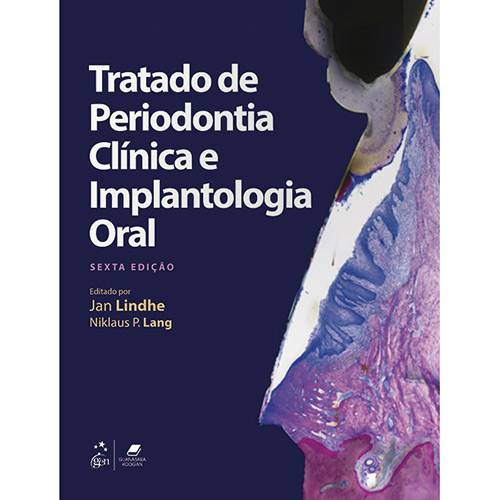 Tamanhos, Medidas e Dimensões do produto Livro - Tratado de Periodontia Clínica e Implantologia Oral