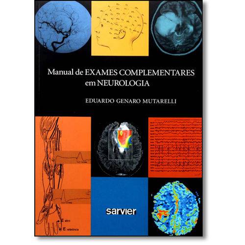 Tamanhos, Medidas e Dimensões do produto Manual de Exames Complementares em Neurologia