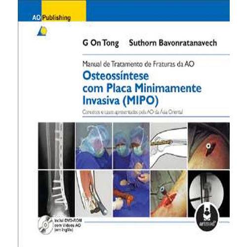 Tamanhos, Medidas e Dimensões do produto Manual de Tratamento de Fraturas da ao - Osteossintese com Placa Minimamente Invasiva (mipo)