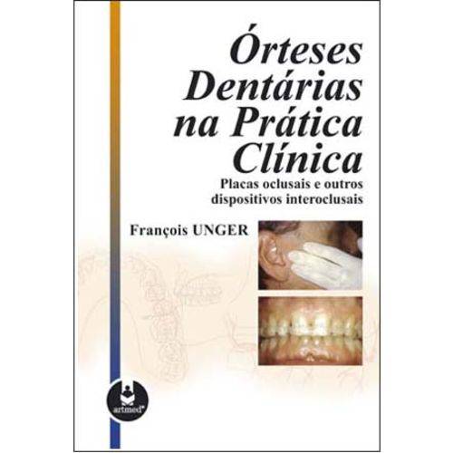 Tamanhos, Medidas e Dimensões do produto Orteses Dentarias na Pratica Clinica