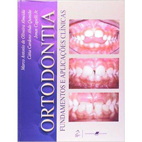 Tamanhos, Medidas e Dimensões do produto Ortodontia Fundamentos e Aplicações Clínicas