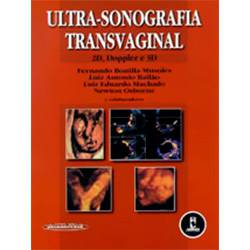 Tamanhos, Medidas e Dimensões do produto Ultra-Sonografia Transvaginal