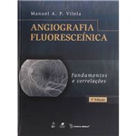 Angiografia Fluoresceínica: Fundamentos e Correlações