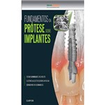 Fundamentos da Prótese Sobre Implantes