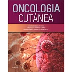Livro - Oncologia Cutânea